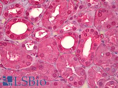 Anti-Calmodulin antibody IHC of human kidney, tubules. Immunohistochemistry of formalin-fixed, paraffin-embedded tissue after heat-induced antigen retrieval. Antibody LS-B6552 dilution 1:50.