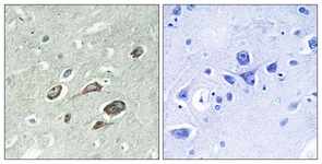 IHC of paraffin-embedded human brain, using Calmodulin (Phospho-Thr79+Ser81) Antibody. The sample on the right was incubated with synthetic peptide.