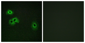 Immunofluorescence of HepG2 cells, using Calmodulin (Phospho-Thr79+Ser81) Antibody. The sample on the right was incubated with synthetic peptide.