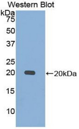 Western blot of recombinant Calmodulin.