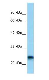 Calneuron-1 / CALN1 antibody Western Blot of COLO205.