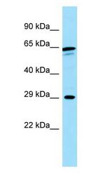 Calneuron-1 / CALN1 antibody Western Blot of COLO205.