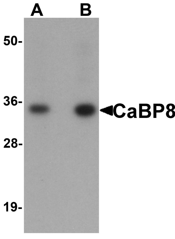 Western blot analysis of CaBP8 in 3T3 cell lysate with CaBP8 antibody at (A) 1 and (B) 2 ug/ml.