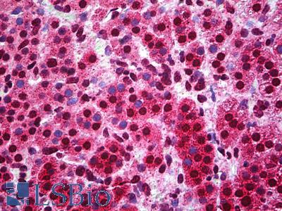 Anti-CIC antibody IHC of human adrenal. Immunohistochemistry of formalin-fixed, paraffin-embedded tissue after heat-induced antigen retrieval. Antibody LS-B5230 concentration 5 ug/ml.