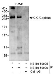 Detection of Human CIC/Capicua by Western Blot of Immunoprecipitates. Samples: Whole cell lysate (1 mg for IP, 20% of IP loaded) from HeLa cells. Antibodies: Affinity purified rabbit anti-CICa antibody used for IP at 3 mcg/mg lysate. CIC was also immunoprecipitated by rabbit anti-CICa antibody, which recognizes a downstream epitope.