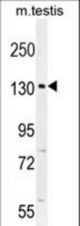 CIC Antibody western blot of mouse testis tissue lysates (35 ug/lane). The CIC antibody detected the CIC protein (arrow).