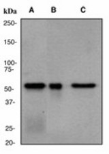 Western blot analysis on (A) U937 (B) human small intestine (C) human liver lysate using anti-ACAT antibody (LS-C105283), dilution 1:50000.