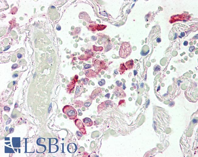 Anti-CES1 antibody IHC of human lung. Immunohistochemistry of formalin-fixed, paraffin-embedded tissue after heat-induced antigen retrieval. Antibody LS-B2401 concentration 5 ug/ml.