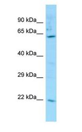 Carboxylesterase 3 / CES3 antibody Western Blot of THP-1.