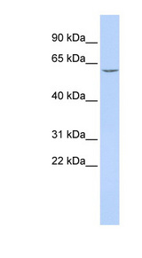 CES5A / CES7 antibody LS-C102374 Western blot of HepG2 cell lysate.