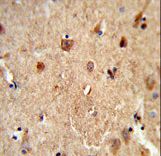 Formalin-fixed and paraffin-embedded human brain tissue reacted with CES7 Antibody , which was peroxidase-conjugated to the secondary antibody, followed by DAB staining. This data demonstrates the use of this antibody for immunohistochemistry; clinical relevance has not been evaluated.