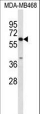 Western blot of CES7 Antibody in MDA-MB468 cell line lysates (35 ug/lane). CES7 (arrow) was detected using the purified antibody.