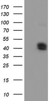 HEK293T cells were transfected with the pCMV6-ENTRY control (Left lane) or pCMV6-ENTRY CPO (Right lane) cDNA for 48 hrs and lysed. Equivalent amounts of cell lysates (5 ug per lane) were separated by SDS-PAGE and immunoblotted with anti-CPO.