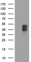 HEK293T cells were transfected with the pCMV6-ENTRY control (Left lane) or pCMV6-ENTRY CPO (Right lane) cDNA for 48 hrs and lysed. Equivalent amounts of cell lysates (5 ug per lane) were separated by SDS-PAGE and immunoblotted with anti-CPO.