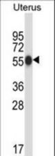 CPO Antibody western blot of human normal Uterus tissue lysates (35 ug/lane). The CPO antibody detected the CPO protein (arrow).