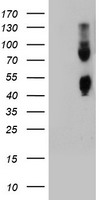 HEK293T cells were transfected with the pCMV6-ENTRY control (Left lane) or pCMV6-ENTRY CPO (Right lane) cDNA for 48 hrs and lysed. Equivalent amounts of cell lysates (5 ug per lane) were separated by SDS-PAGE and immunoblotted with anti-CPO.
