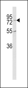 Western blot of CPZ Antibody in K562 cell line lysates (35 ug/lane). CPZ (arrow) was detected using the purified antibody.