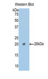 Western blot of recombinant Carboxypeptidase E / CPE.