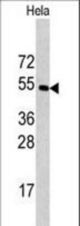 Western blot of CPE antibody in HeLa cell line lysates (35 ug/lane). CPE (arrow) was detected using the purified antibody.
