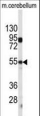 Western blot of CPE antibody in mouse cerebellum tissue lysates (35 ug/lane). CPE (arrow) was detected using the purified antibody.
