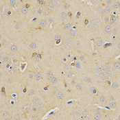 Immunohistochemistry of paraffin-embedded rat brain using CPE antibody at dilution of 1:200 (x400 lens).