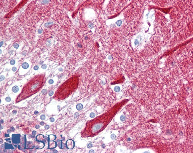 Anti-CPE antibody IHC of human brain, cerebellum. Immunohistochemistry of formalin-fixed, paraffin-embedded tissue after heat-induced antigen retrieval. Antibody LS-B6638 concentration 5 ug/ml.