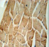 CRLS1 Antibody immunohistochemistry of formalin-fixed and paraffin-embedded human skeletal muscle followed by peroxidase-conjugated secondary antibody and DAB staining.