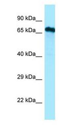 Cdc14 / CDC14A antibody Western Blot of RPMI-8226.