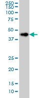 LASS6 monoclonal antibody (M01), clone 5H7 Western blot of LASS6 expression in HeLa.