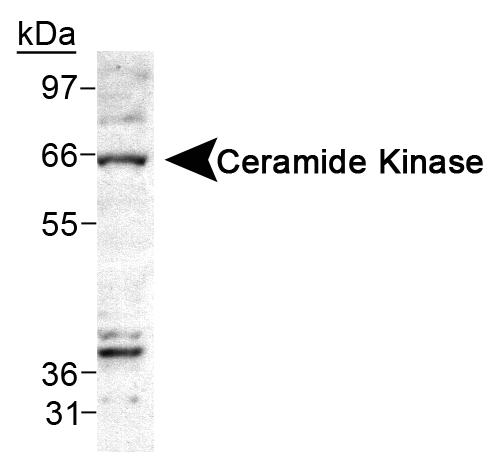 Detection of Ceramide Kinase in A549 cell lysate.