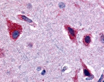 CERK staining of formalin fixed paraffin embedded human brain (cortex) tissue at a dilution of 20 ug/ml. Antigen retrieval using a citrate buffer and steam/heat was utilized.