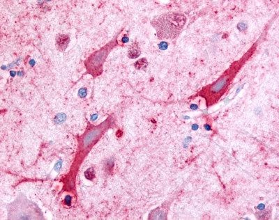 CERK staining of formalin fixed paraffin embedded human brain (cortex) tissue at a dilution of 20 ug/ml. Antigen retrieval using a citrate buffer and steam/heat was utilized.