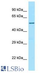 Ceramide Kinase / CERK antibody Western Blot of 721_B. Antibody dilution: 1 ug/ml.