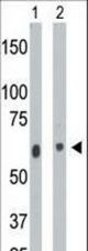 The anti-CERK antibody is used in Western blot to detect CERK in mouse heart tissue lysate (Lane 1) and A2058 cell lysate (Lane 2).