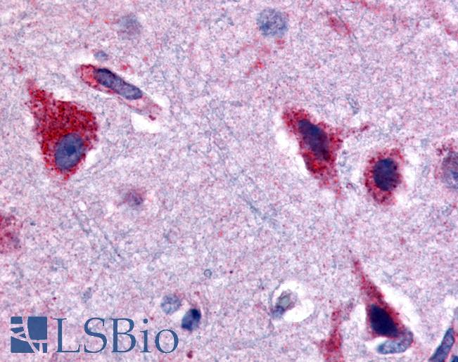 Anti-CERK antibody LS-A4556 IHC of human brain, cortex. Immunohistochemistry of formalin-fixed, paraffin-embedded tissue after heat-induced antigen retrieval.