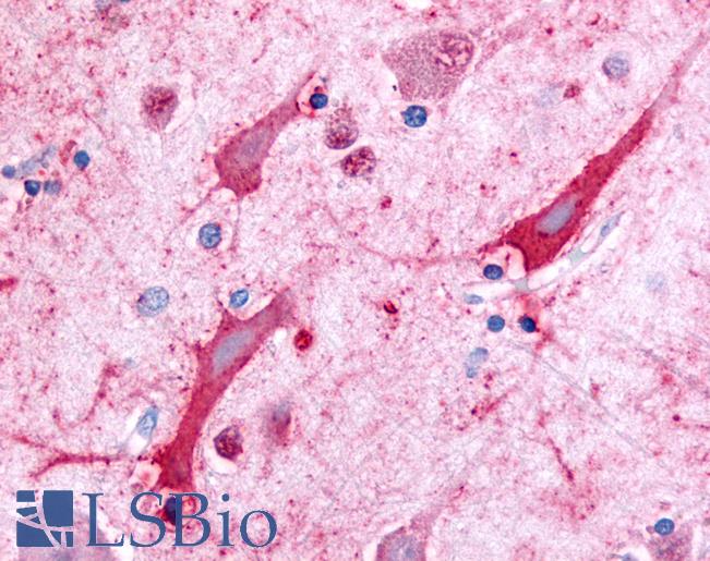 Anti-CERK antibody LS-A3369 IHC of human brain, cortex. Immunohistochemistry of formalin-fixed, paraffin-embedded tissue after heat-induced antigen retrieval.