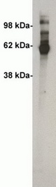 Western blot of Ceramide Kinase antibody (X1705P) on 30 ng of recombinant ceramide kinase. Antibody used at 2 ug/ml. Visualized using Pierce West Femto substrate system. Secondary used at 1:75k dilution. Exposure for 60 seconds.