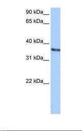 HEPG2 cell lysate. Antibody concentration: 0.5 ug/ml. Gel concentration: 12%.