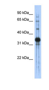 CHAD antibody LS-C111345 Western blot of Transfected 293T cell lysate.
