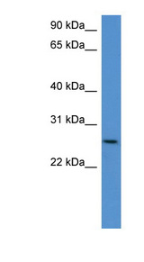 CHODL antibody LS-C135305 Western blot of Mouse Kidney lysate.