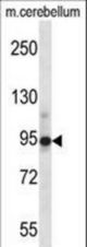 CHRD Antibody western blot of mouse cerebellum tissue lysates (35 ug/lane). The CHRD antibody detected the CHRD protein (arrow).