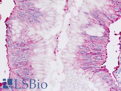 Human Pancreas: Formalin-Fixed, Paraffin-Embedded (FFPE)