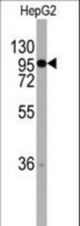 Western blot of anti-CHRD Antibody (RB14089) in HepG2 cell line lysates (35 ug/lane). CHRD(arrow) was detected using the purified antibody.