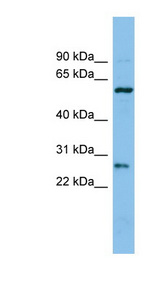 CTRB1 antibody LS-C115973 Western blot of COLO205 cell lysate.