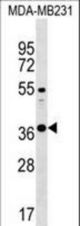 CTRB1 Antibody western blot of MDA-MB231 cell line lysates (35 ug/lane). The CTRB1 antibody detected the CTRB1 protein (arrow).