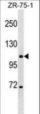 CLCN3 Antibody western blot of ZR-75-1 cell line lysates (35 ug/lane). The CLCN3 antibody detected the CLCN3 protein (arrow).