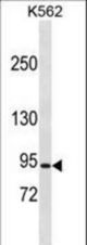 CLCN5 Antibody western blot of K562 cell line lysates (35 ug/lane). The CLCN5 antibody detected the CLCN5 protein (arrow).