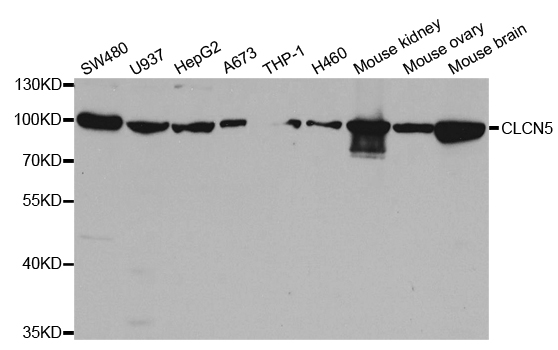 Western blot analysis of extracts of various cell lines, using CLCN5 antibody.