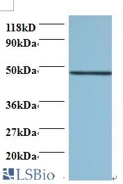 Western blot of Protein canopy homolog 2 antibody at 2 ug/ml + 293T whole cell lysate. Secondary: Goat polyclonal to Rabbit IgG at 1:15000 dilution. Predicted band size: 20 kDa. Observed band size: 47 kDa.