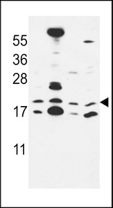 CNPY2 Antibody western blot of MCF-7,NCI-H460,HepG2,HeLa cell line lysates (35 ug/lane). The CNPY2 antibody detected the CNPY2 protein (arrow).